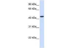 TRDMT1 antibody used at 1 ug/ml to detect target protein. (Dnmt2 antibody  (N-Term))