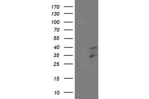 HEK293T cells were transfected with the pCMV6-ENTRY control (Left lane) or pCMV6-ENTRY HOXC11 (Right lane) cDNA for 48 hrs and lysed. (HOXC11 antibody)
