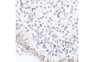 Immunohistochemistry (Paraffin-embedded Sections) (IHC (p)) image for anti-Nuclear Factor of kappa Light Polypeptide Gene Enhancer in B-Cells 2 (NFKB2) (AA 690-899) antibody (ABIN3017388)