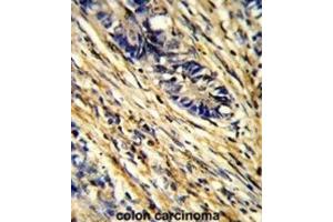 Immunohistochemistry (IHC) image for anti-14-3-3 gamma (YWHAG1) antibody (ABIN3001731) (14-3-3 gamma antibody)