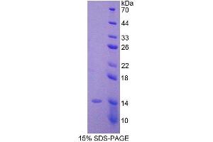 SDS-PAGE (SDS) image for Anti-Mullerian Hormone (AMH) (AA 453-560) protein (His tag) (ABIN1078846) (AMH Protein (AA 453-560) (His tag))
