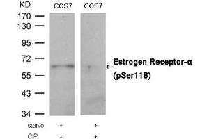 Western blot analysis of extracts from COS7 cells, treated with starve or calf intestinal phosphatase (CIP), using Estrogen Receptor-α (Phospho-Ser118) Antibody. (Estrogen Receptor alpha antibody  (pSer118))