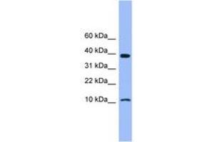 Image no. 1 for anti-Cystatin B (Stefin B) (CSTB) (AA 20-69) antibody (ABIN6745436) (CSTB antibody  (AA 20-69))