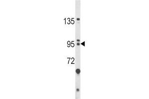 Western Blotting (WB) image for anti-Bicaudal C Homolog 1 (BICC1) antibody (ABIN3002907) (BICC1 antibody)
