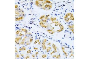 Immunohistochemistry of paraffin-embedded human stomach using CYP2E1 antibody (ABIN3023078, ABIN3023079, ABIN3023080 and ABIN6219379) at dilution of 1:100 (40x lens). (CYP2E1 antibody  (AA 234-493))