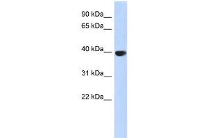 WB Suggested Anti-AURKC Antibody Titration: 0. (Aurora Kinase C antibody  (Middle Region))