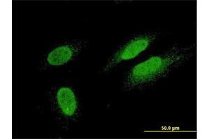 Immunofluorescence of monoclonal antibody to TTN on HeLa cell. (Titin antibody  (AA 1-110))