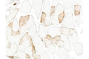 Immunohistochemistry (IHC) image for anti-Myoglobin (MB) antibody (ABIN7795606)
