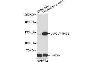 Western blot analysis of extracts of NIH/3T3 cells,using Phospho-ACLY-S455 antibody. (ACLY antibody  (pSer455))
