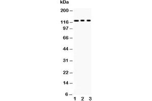 Western blot testing of PLD1 antibody and Lane 1:  mouse heart;  2: 22RV1;  3: HeLa;  Predicted size: 124KD;  Observed size: 124KD (PLD1 antibody  (AA 1-330))