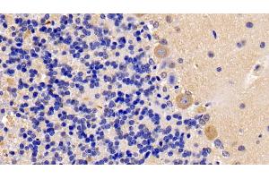 Immunohistochemistry (IHC) image for anti-Oncostatin M Receptor (OSMR) (AA 503-749) antibody (ABIN7439711)