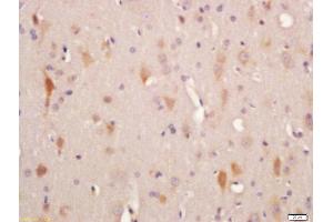 Immunohistochemistry (Paraffin-embedded Sections) (IHC (p)) image for anti-Adenylate Cyclase 10 (Soluble) (ADCY10) (AA 1101-1200) antibody (ABIN751093)