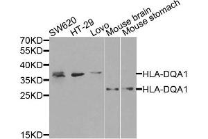 Western blot analysis of extracts of various cells, using HLA-DQA1 antibody.