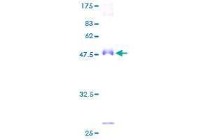 AMACR Protein (AA 1-198) (GST tag)