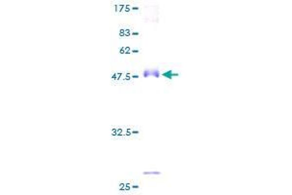 AMACR Protein (AA 1-198) (GST tag)