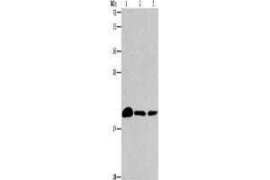 Gel: 15 % SDS-PAGE, Lysate: 40 μg, Lane 1-3: Mouse brain tissue, 231 cells, A375 cells, Primary antibody: ABIN7189902(ARL3 Antibody) at dilution 1/433, Secondary antibody: Goat anti rabbit IgG at 1/8000 dilution, Exposure time: 2 minutes (ARL3 antibody)