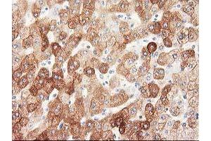 Immunohistochemical staining of paraffin-embedded Human liver tissue using anti-NHEJ1 mouse monoclonal antibody. (NHEJ1 antibody)