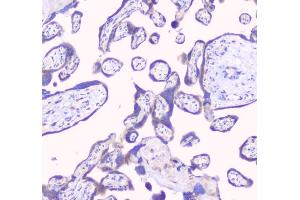 IHC analysis of RPS3 using anti-RPS3 antibody (ABIN6719371). (RPS3 antibody)