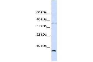 HSPE1 antibody used at 1 ug/ml to detect target protein.