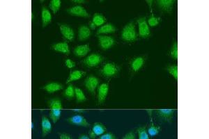 Immunofluorescence analysis of U2OS cells using EYA3 Polyclonal Antibody at dilution of 1:100. (EYA3 antibody)
