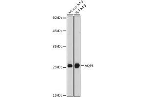 Western blot analysis of extracts of various cell lines, using  antibody (ABIN6133586, ABIN6137050, ABIN6137052 and ABIN6225252) at 1:1000 dilution. (Aquaporin 5 antibody  (AA 150-250))