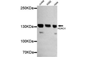 Western blot detection of HDAC4 in Jurkat,Hela and K562 cell lysates using HDAC4 mouse mAb (1:1000 diluted). (HDAC4 antibody  (N-Term))