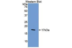 Detection of Recombinant F8, Human using Polyclonal Antibody to Coagulation Factor VIII (F8) (Factor VIII antibody  (AA 2253-2346))