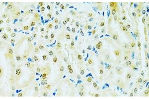 Immunohistochemistry (Paraffin-embedded Sections) (IHC (p)) image for anti-Regulator of Chromosome Condensation 1 (RCC1) antibody (ABIN7262150)
