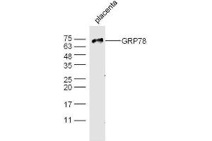 Mouse placenta probed with Rabbit Anti-GRP78 Polyclonal Antibody, Unconjugated  at 1:500 for 90 min at 37˚C. (GRP78 antibody  (AA 251-360))