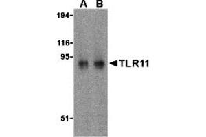 Western Blotting (WB) image for anti-Toll-Like Receptor 11 (Tlr11) (C-Term) antibody (ABIN1030741)