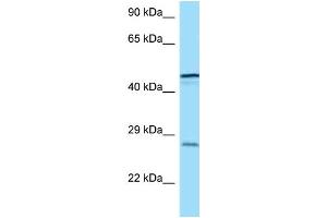 WB Suggested Anti-TREM1 Antibody Titration: 1. (TREM1 antibody  (C-Term))