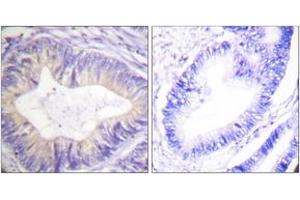Immunohistochemistry (IHC) image for anti-Cas-Br-M (Murine) Ecotropic Retroviral Transforming Sequence (CBL) (AA 740-789) antibody (ABIN2888650) (CBL antibody  (AA 740-789))