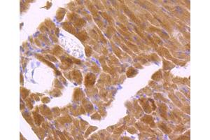 Immunohistochemistry (Paraffin-embedded Sections) (IHC (p)) image for anti-SMAD, Mothers Against DPP Homolog 2 (SMAD2) (pThr183), (pThr221) antibody (ABIN3061343)