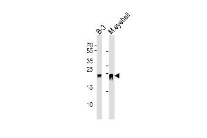 Western blot analysis of lysates from B-3 cell line and mouse eyeball tissue lysate(from left to right), using CRYBB2 Antibody (N-term) (ABIN6243390 and ABIN6577568). (CRYbB2 antibody  (N-Term))