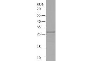 COASY Protein (AA 296-564) (His tag)