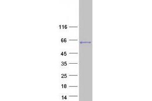 LEMD2 Protein (Transcript Variant 1) (Myc-DYKDDDDK Tag)