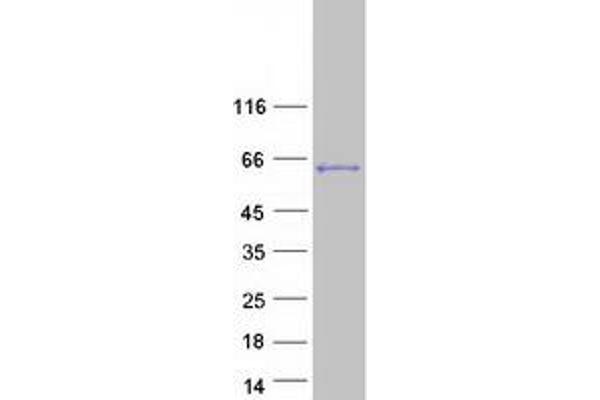 LEMD2 Protein (Transcript Variant 1) (Myc-DYKDDDDK Tag)