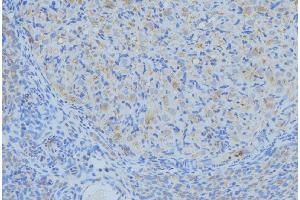 ABIN6276333 at 1/100 staining Human uterus tissue by IHC-P. (Nerve Growth Factor antibody  (Internal Region))