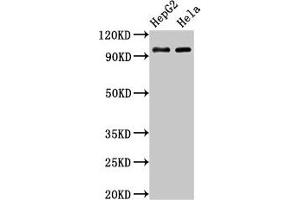 Western Blot Positive WB detected in: HepG2 whole cell lysate, Hela whole cell lysate All lanes: ACO1 antibody at 3 μg/mL Secondary Goat polyclonal to rabbit IgG at 1/50000 dilution Predicted band size: 99 kDa Observed band size: 99 kDa