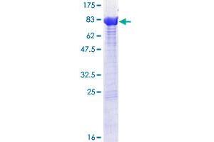 PPP2R1B Protein (AA 1-601) (GST tag)