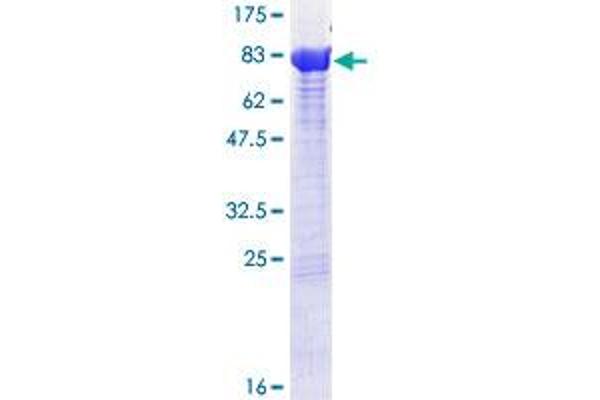 PPP2R1B Protein (AA 1-601) (GST tag)