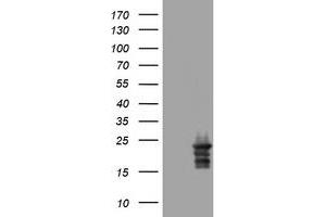 Image no. 3 for anti-Visinin-Like 1 (VSNL1) (AA 2-191) antibody (ABIN1491123) (VSNL1 antibody  (AA 2-191))