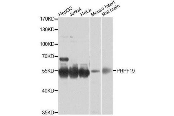 PRP19 Antikörper  (AA 127-416)