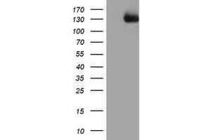 Western Blotting (WB) image for anti-PTK7 Protein tyrosine Kinase 7 (PTK7) antibody (ABIN1497127) (PTK7 antibody)