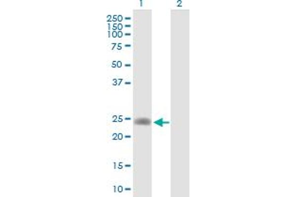 LDHAL6A antibody  (AA 1-234)