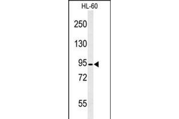 Calpain 3 antibody  (C-Term)