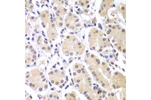 Immunohistochemistry of paraffin-embedded human gastric using CHEK1 antibody. (CHEK1 antibody)