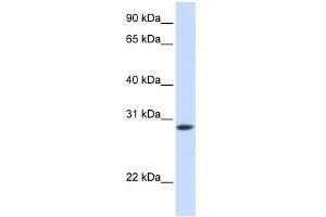 WB Suggested Anti-TNNT3 Antibody Titration:  0. (TNNT3 antibody  (C-Term))