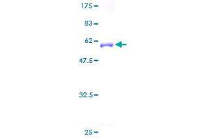ARPC2 Protein (AA 1-300) (GST tag)