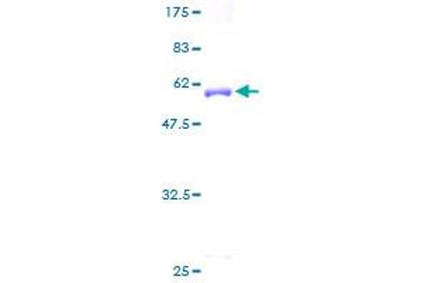 ARPC2 Protein (AA 1-300) (GST tag)